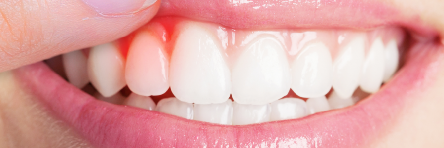 又上火又怕冷？上熱下寒、水火不濟(jì)，教你調(diào)回來！