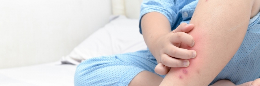 學(xué)古人這樣驅(qū)蚊，從此不再“蚊”風(fēng)喪膽！