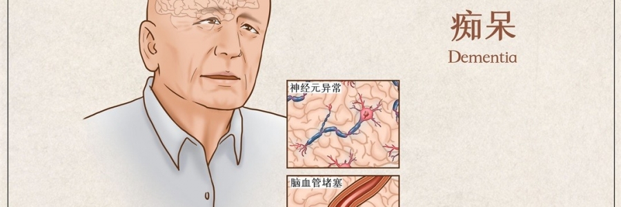 “馬什么梅？”年紀(jì)輕輕老忘事，竟是癡呆的前兆？！